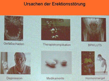 erek008